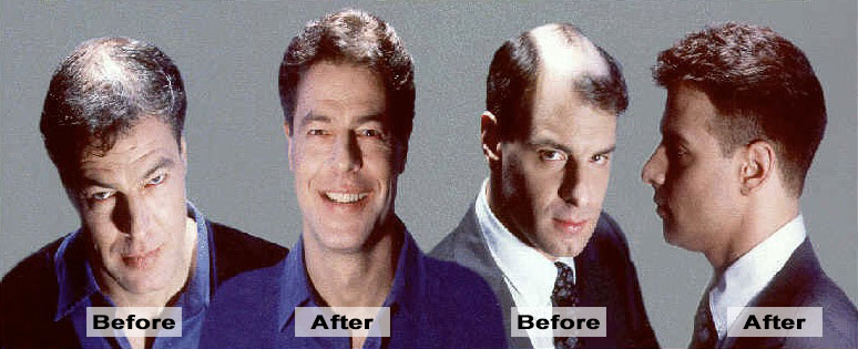 Hair Replacement for Men New York City Gloria Wan Hair Design